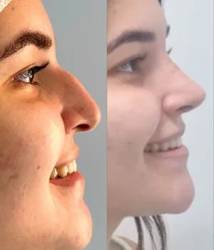 antes e depois procedimentos