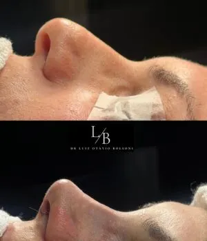 antes e depois procedimentos