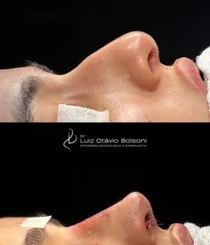 antes e depois procedimentos