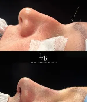 antes e depois procedimentos